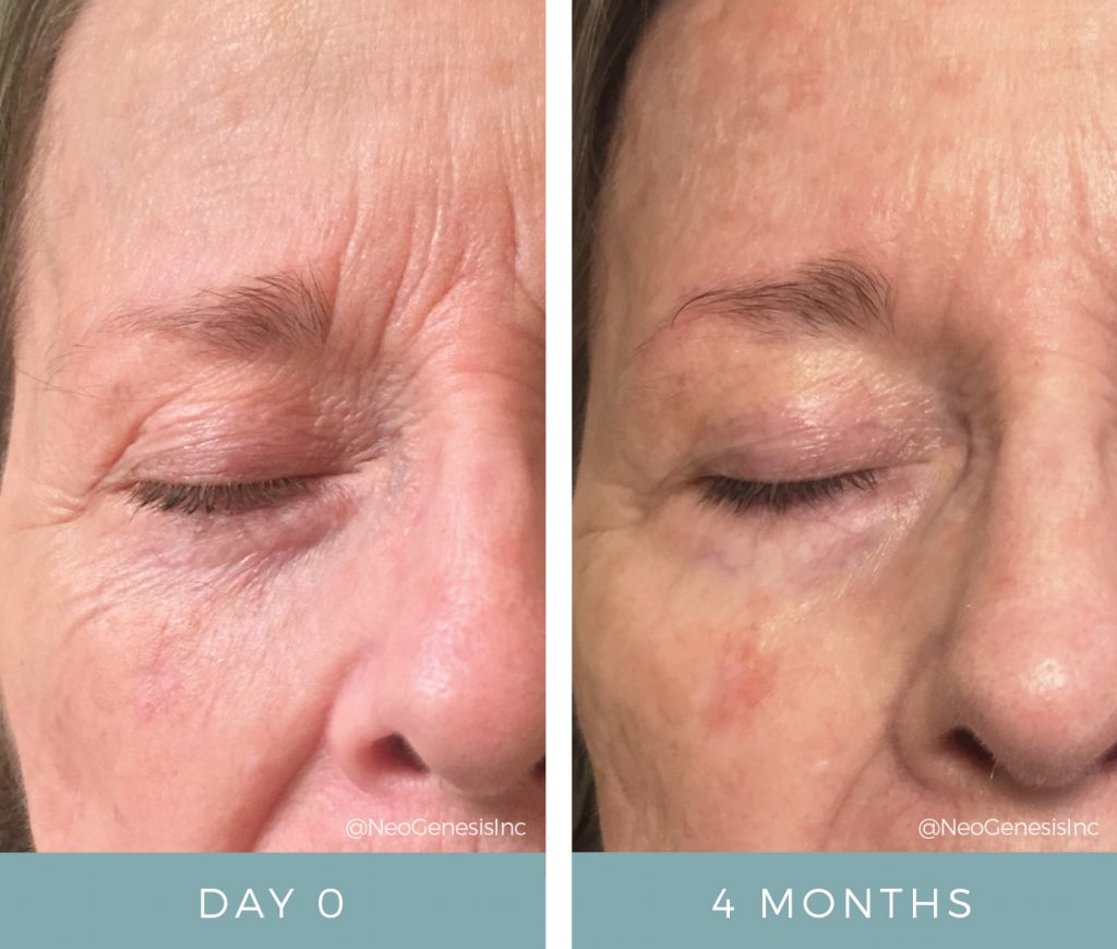 Before + After - Aging Skin