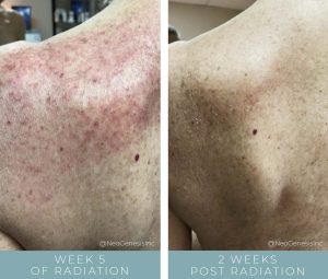 Before + After - Radiation Skin Care