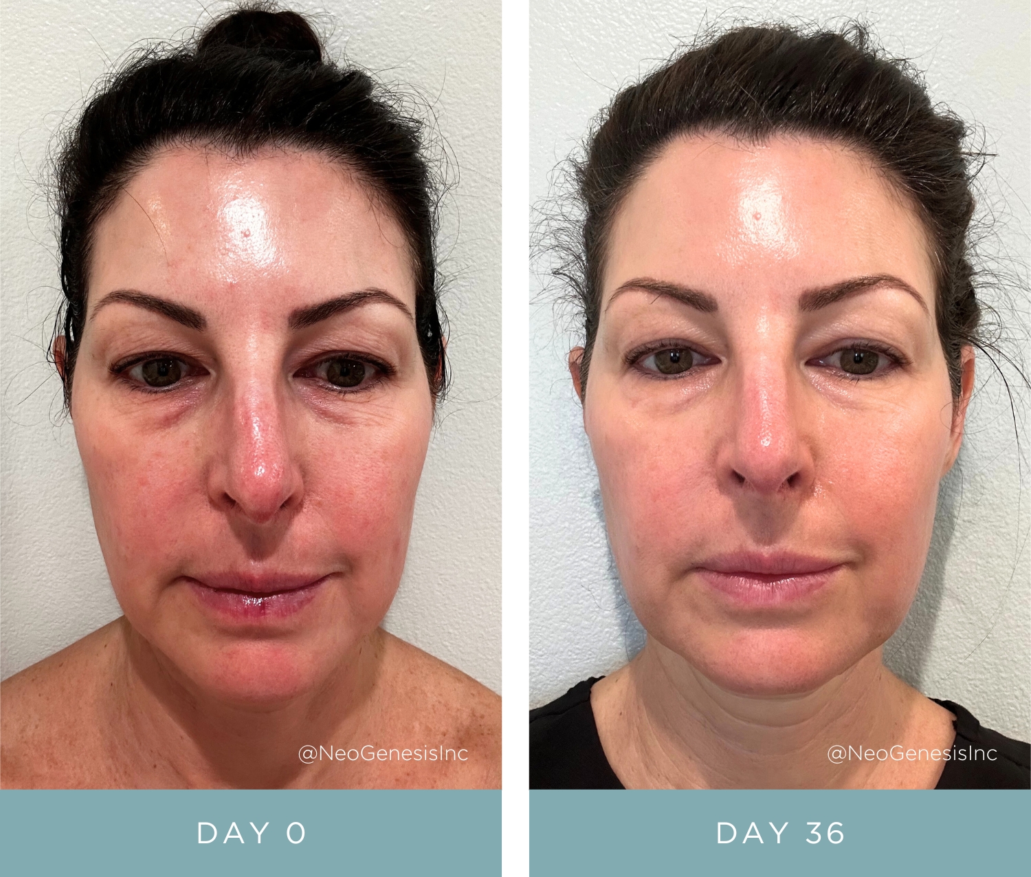 Before + After - NeoGenesis Vibrant C Serum